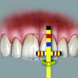 RECHARGE POUR JAUGE ALL. DE COURONNES HU-FRIEDY TBARREF 